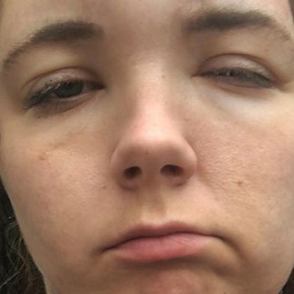 بلایی که رنگ مو بر صورت این زن آورد (+عکس)